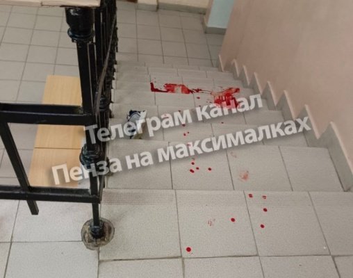 Следователи разбираются в обстоятельствах травмирования 10-летнего школьника в Пензе